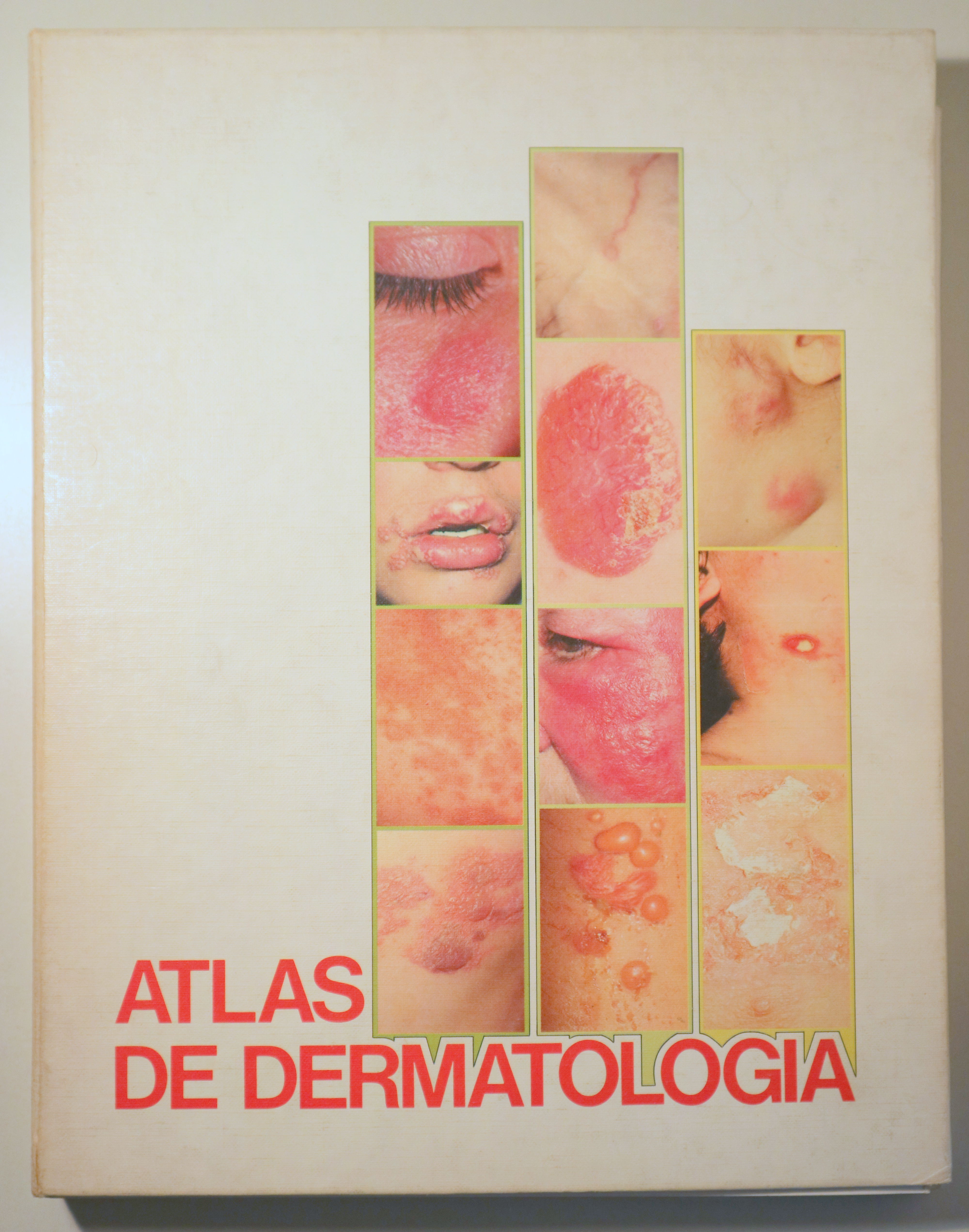 ATLAS DE DERMATOLOGÍA - Barcelona 1983 - Muy ilustrado