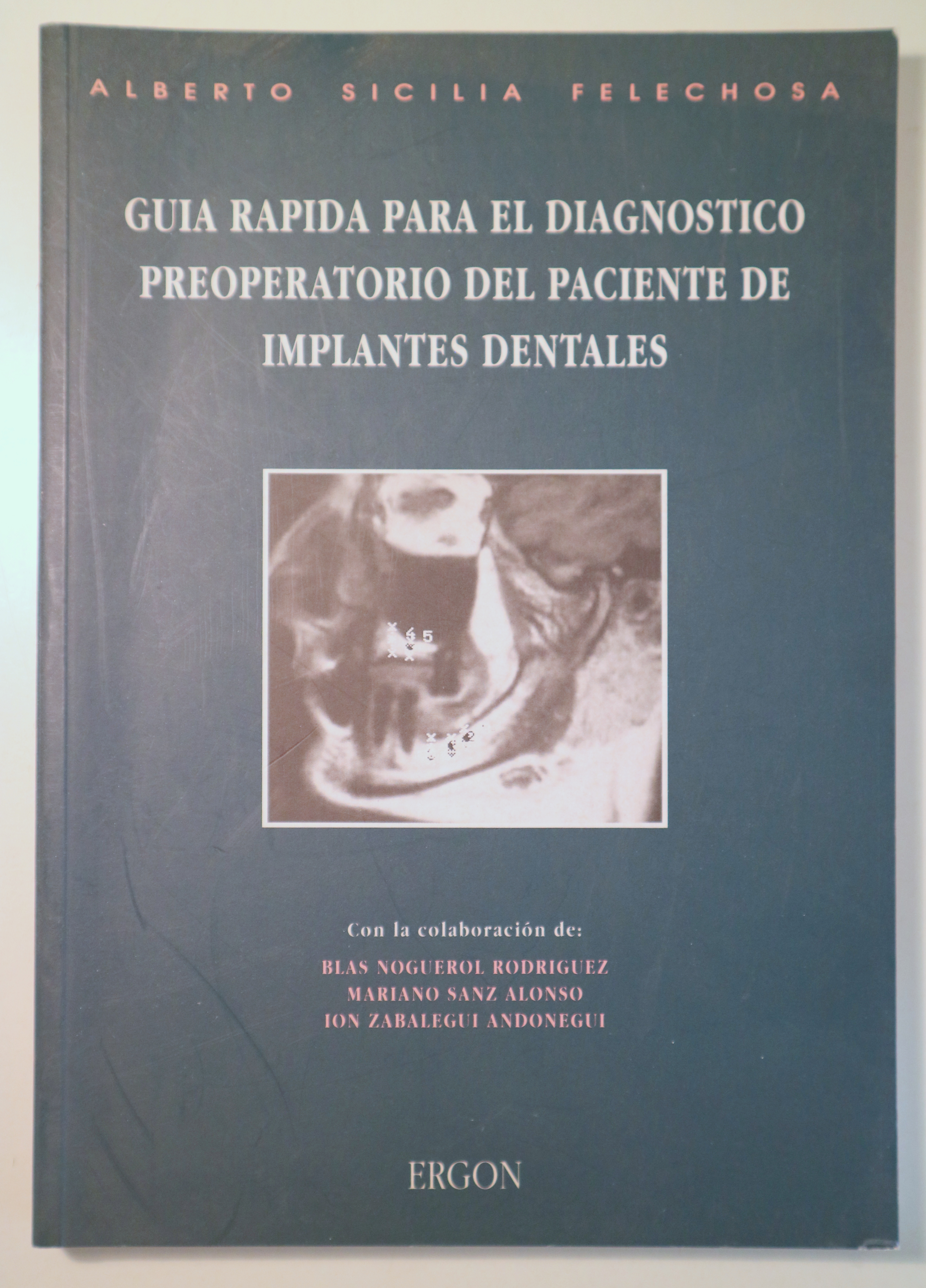 GUÍA RÁPIDA PARA EL DIAGNÓSTICO PREOPERATORIO DEL PACIENTE DE IMPLANTES DENTALES - Madrid 1993 - Muy ilustrado